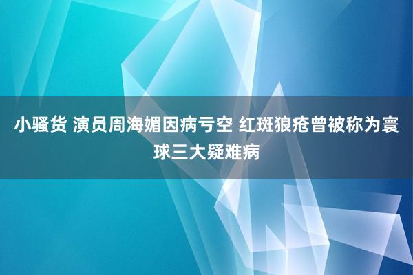 小骚货 演员周海媚因病亏空 红斑狼疮曾被称为寰球三大疑难病